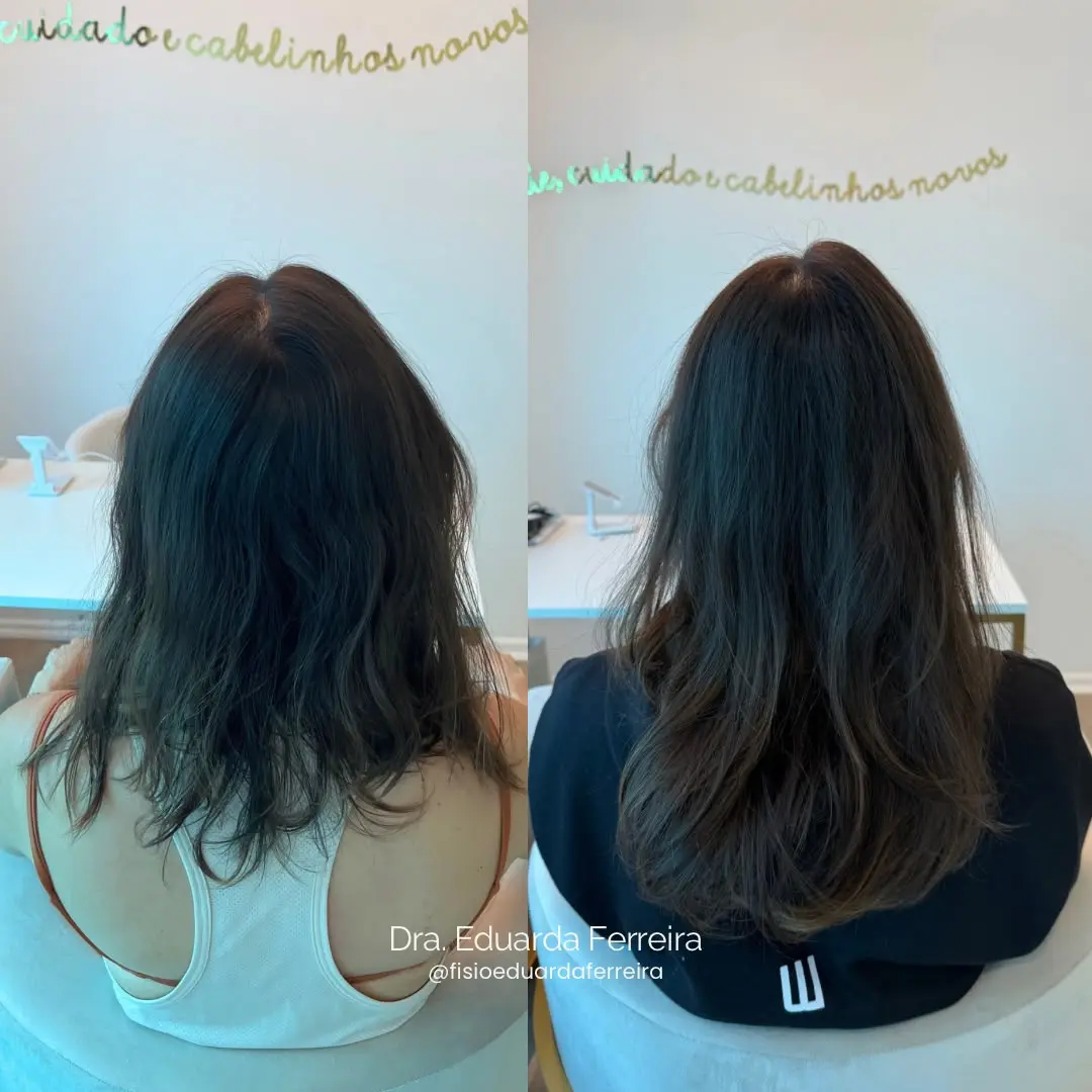 Resultado do tratamento capilar - Antes e Depois 5